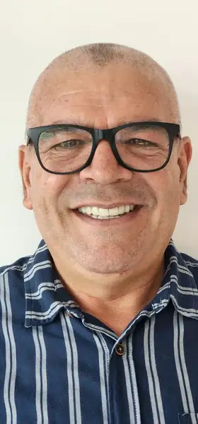 Después - Carillas y coronas de porcelana